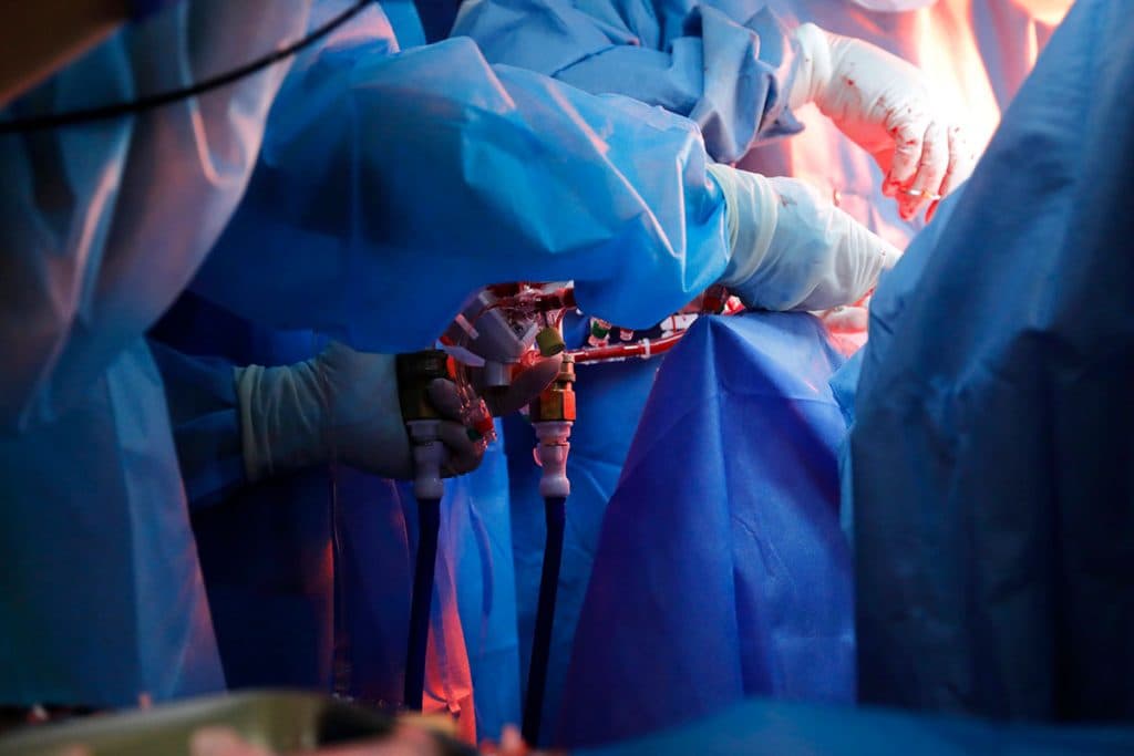 Avant-Garde Experiment: Animal Fetuses Survive 12 Days